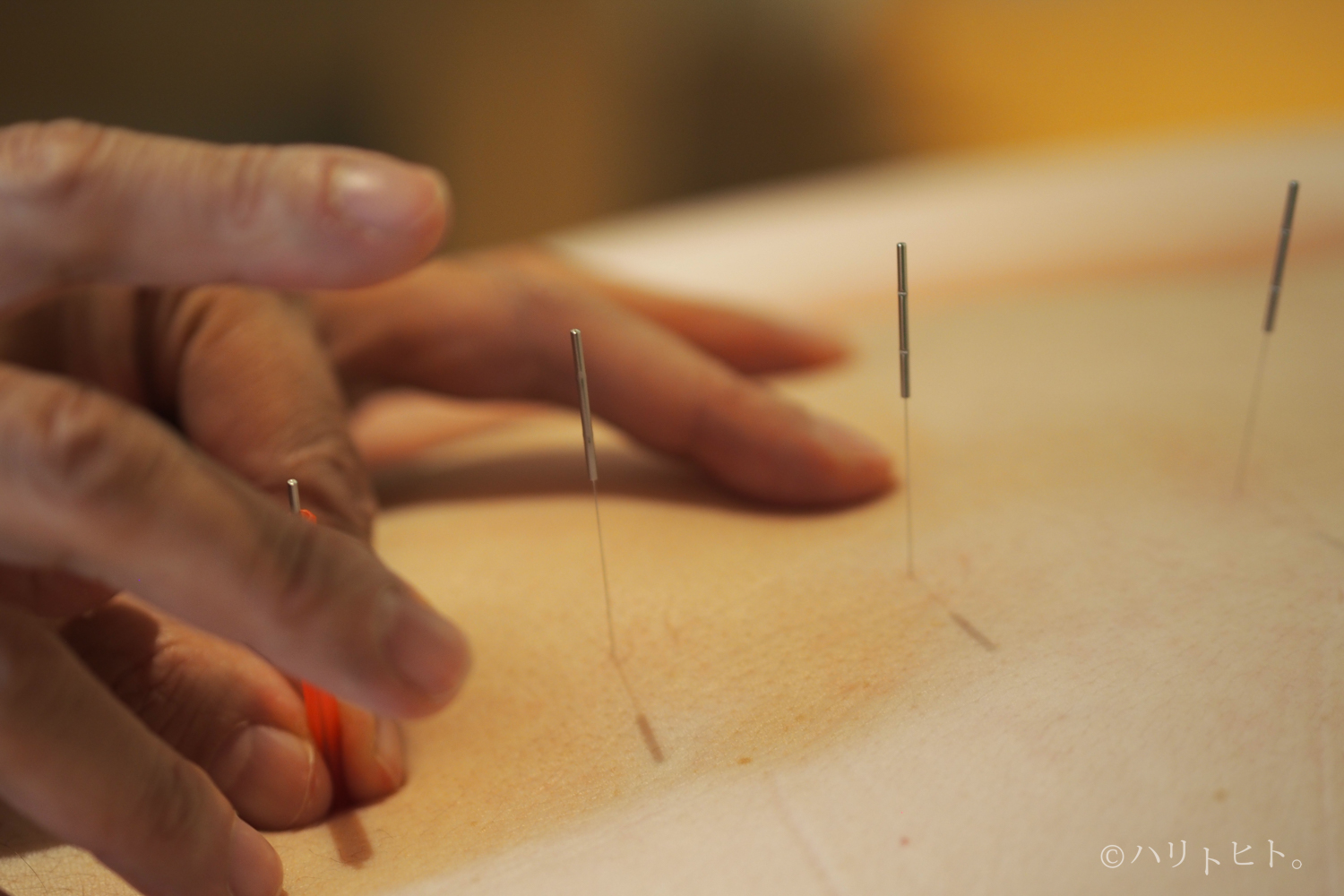 置鍼時間と治療効果の関連とは？／鍼灸師・博士（鍼灸学）：山﨑 翼